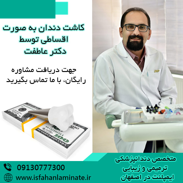ایمپلنت دندان اقساطی در اصفهان+شرایط پرداخت و دریافت مشاوره رایگان